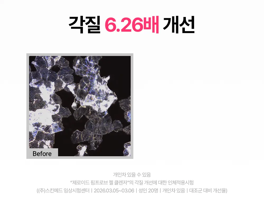 [트러블 피부 추천/여드름균 항균 클렌징] 제로이드 핌프로브 젤 클렌저 180ml 상세페이지 21